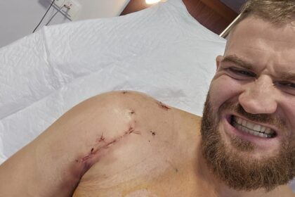 Former Ufc Champion Jan Blachowicz Undergoes Surgery On Both Shoulders: