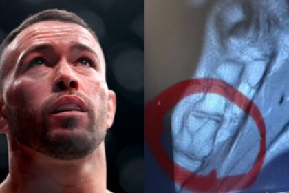 Colby Covington Releases X Rays Of Broken Leg Suffered In Loss