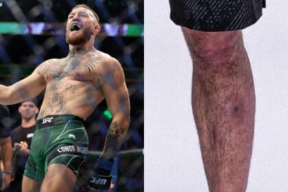 Conor Mcgregor Criticizes Islam Makhachev Over Infection Speculation Before Ufc