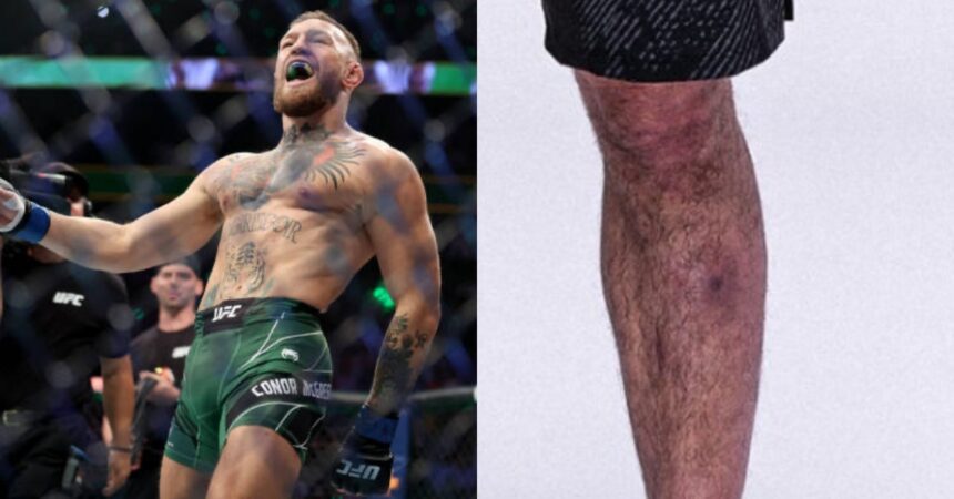 Conor Mcgregor Criticizes Islam Makhachev Over Infection Speculation Before Ufc