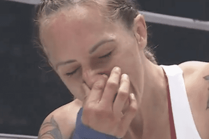 See Tai Emery Viciously Fracture Charisa Sigala's Nose During Bare Knuckle