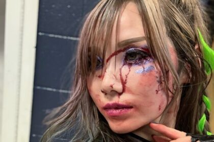 Kairi Sane's Injury Update Following 9/2 Wwe Raw