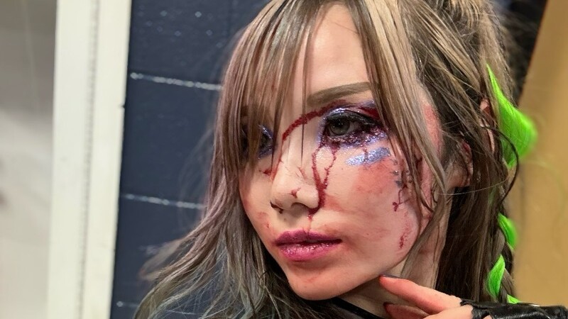 Kairi Sane's Injury Update Following 9/2 Wwe Raw